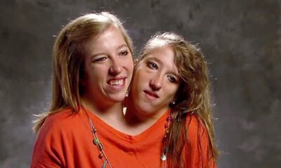 Conjoined twins Brittany and Abby Hensel respond to ‘loud’ comments after Josh Bowling wedding reveal – NBC Connecticut