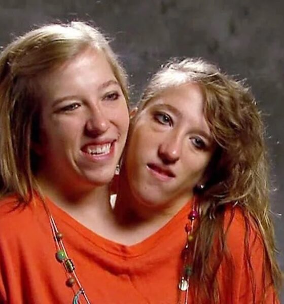 Conjoined twins Brittany and Abby Hensel respond to ‘loud’ comments after Josh Bowling wedding reveal – NBC Connecticut
