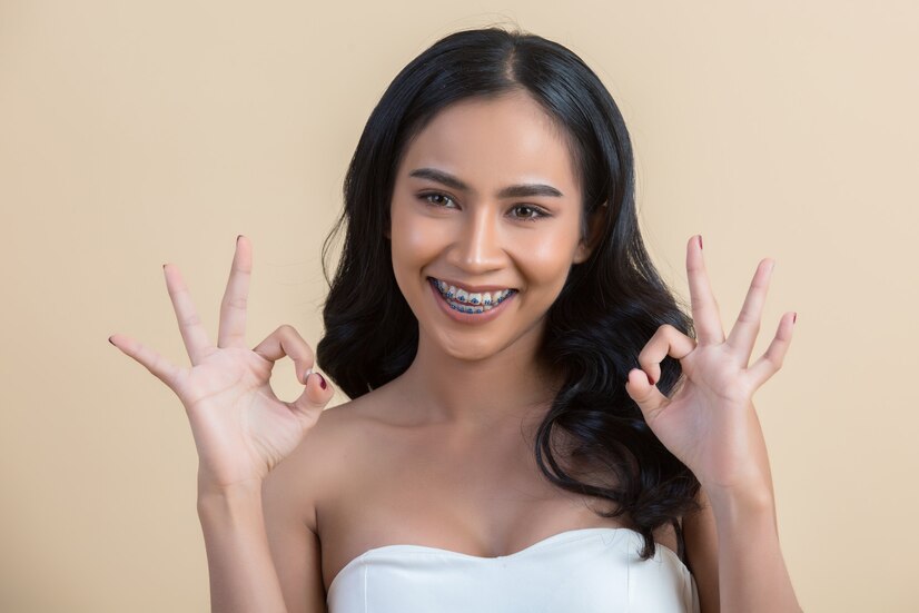 Clear Braces, Clear Benefits: The Advantages of Clear Aligners in Altamonte Springs