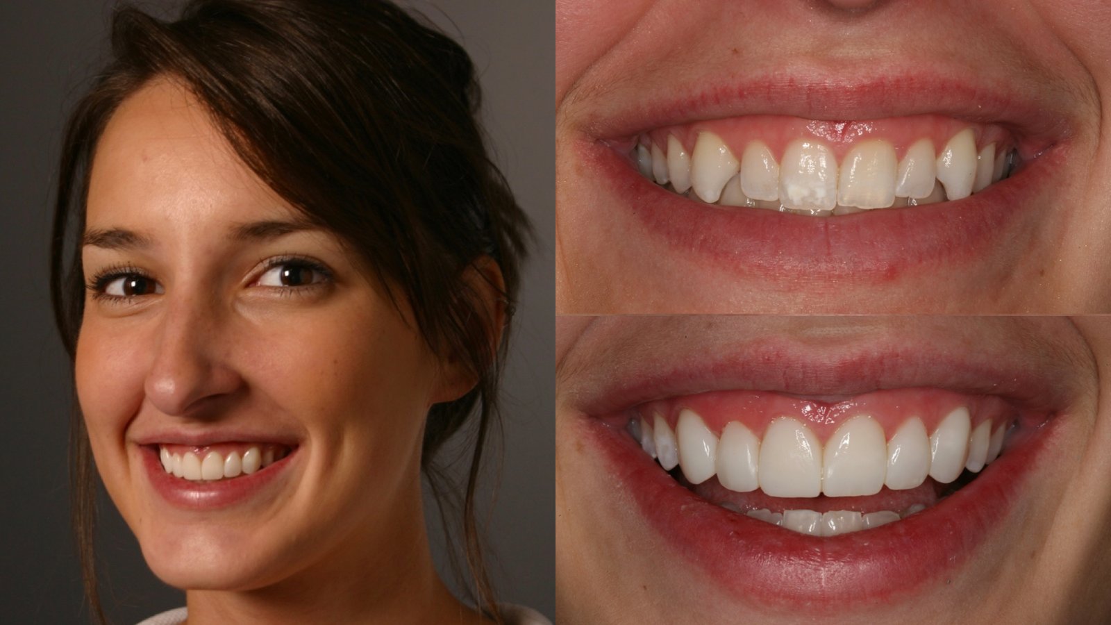 Transforming Smiles with Precision and Artistry