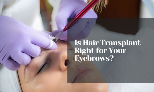 Is Hair Transplant Right for Your Eyebrows?