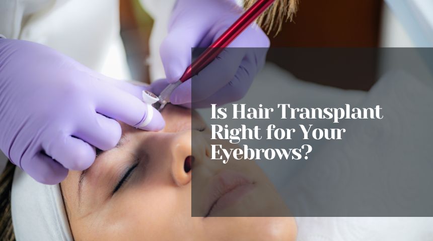 Is Hair Transplant Right for Your Eyebrows?